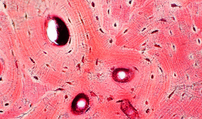 Bindegewebserkrankung: Eine umfassende Übersicht