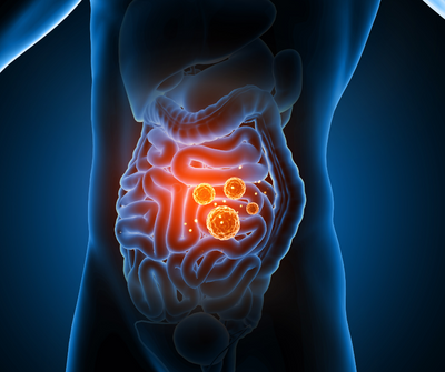 Leaky Gut heilen: So stärkst Du Deine Darmgesundheit