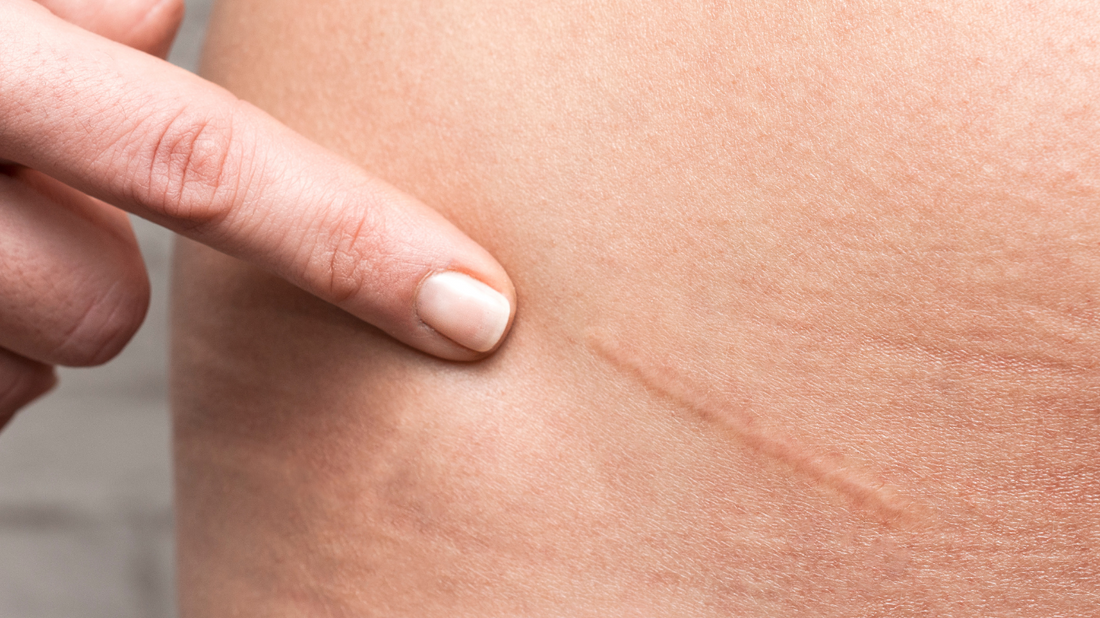 Haut und Darmflora: Der Zusammenhang zwischen gesunder Haut und Darmgesundheit